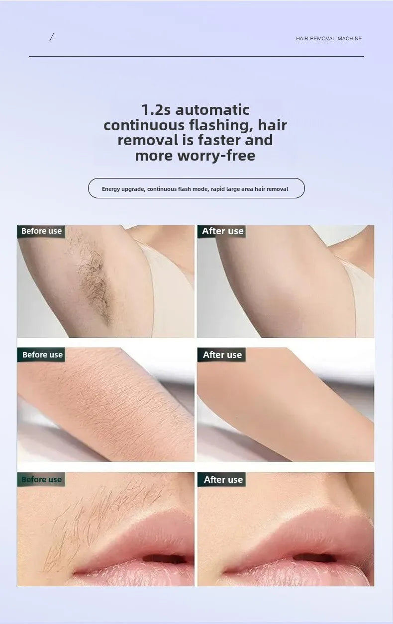 Portable IPL Laser Hair Removal Device with Ice Cooling System Painless for Smooth Skin