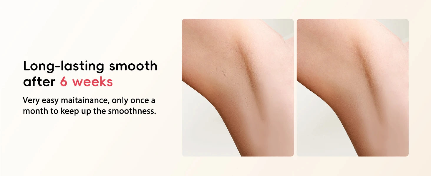 Professional IPL Hair Removal 22J Unlimted Flashes Painless Laser Epilator  Armpits Legs Arms Bikini Line Treament Home Use