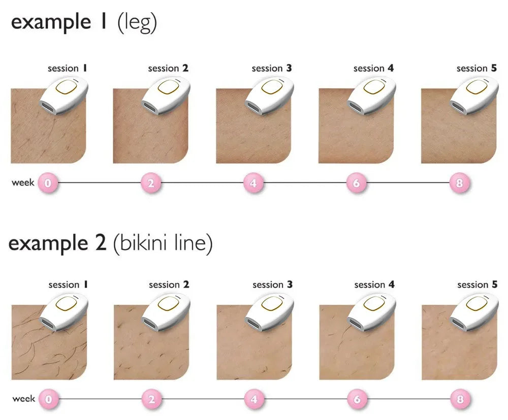 Laser photon skin rejuvenation and hair removal device for whole body painless hair removal device for men and women