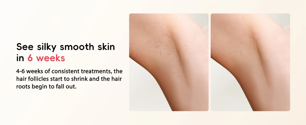 Professional IPL Hair Removal 22J Unlimted Flashes Painless Laser Epilator  Armpits Legs Arms Bikini Line Treament Home Use
