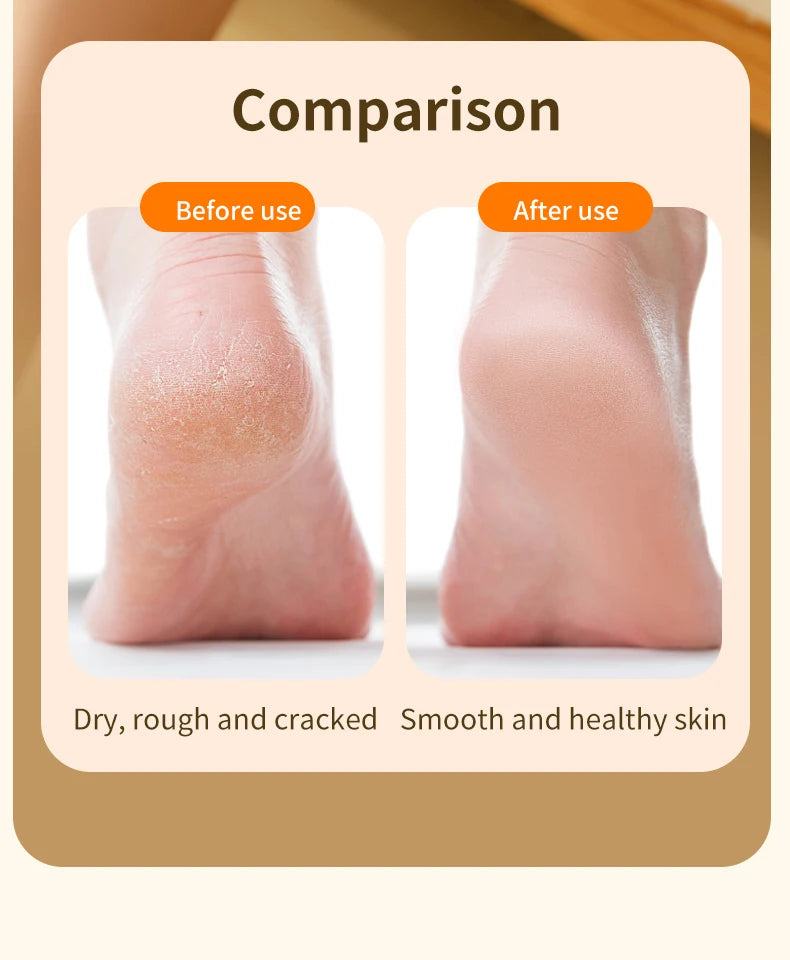 Electric Foot Grinder Automatic Foot Callus Rubbing Pedicure Dead Skin Callus Remover for Foot Rechargeable Foot Beauty Machine