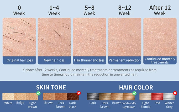 Mlay T18 ICE Cooling Hair Removal Device With Unlimited Shots Permanent IPL Laser Home Use Painless Epilator For Women Men