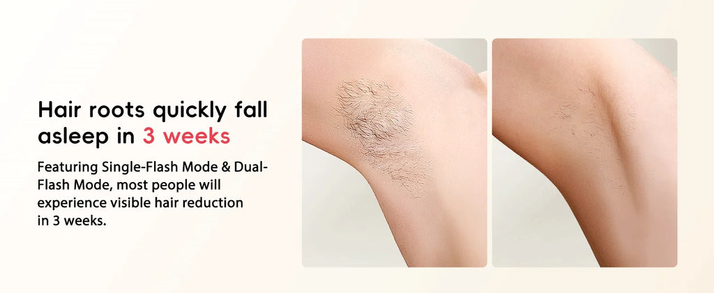 Professional IPL Hair Removal 22J Unlimted Flashes Painless Laser Epilator  Armpits Legs Arms Bikini Line Treament Home Use