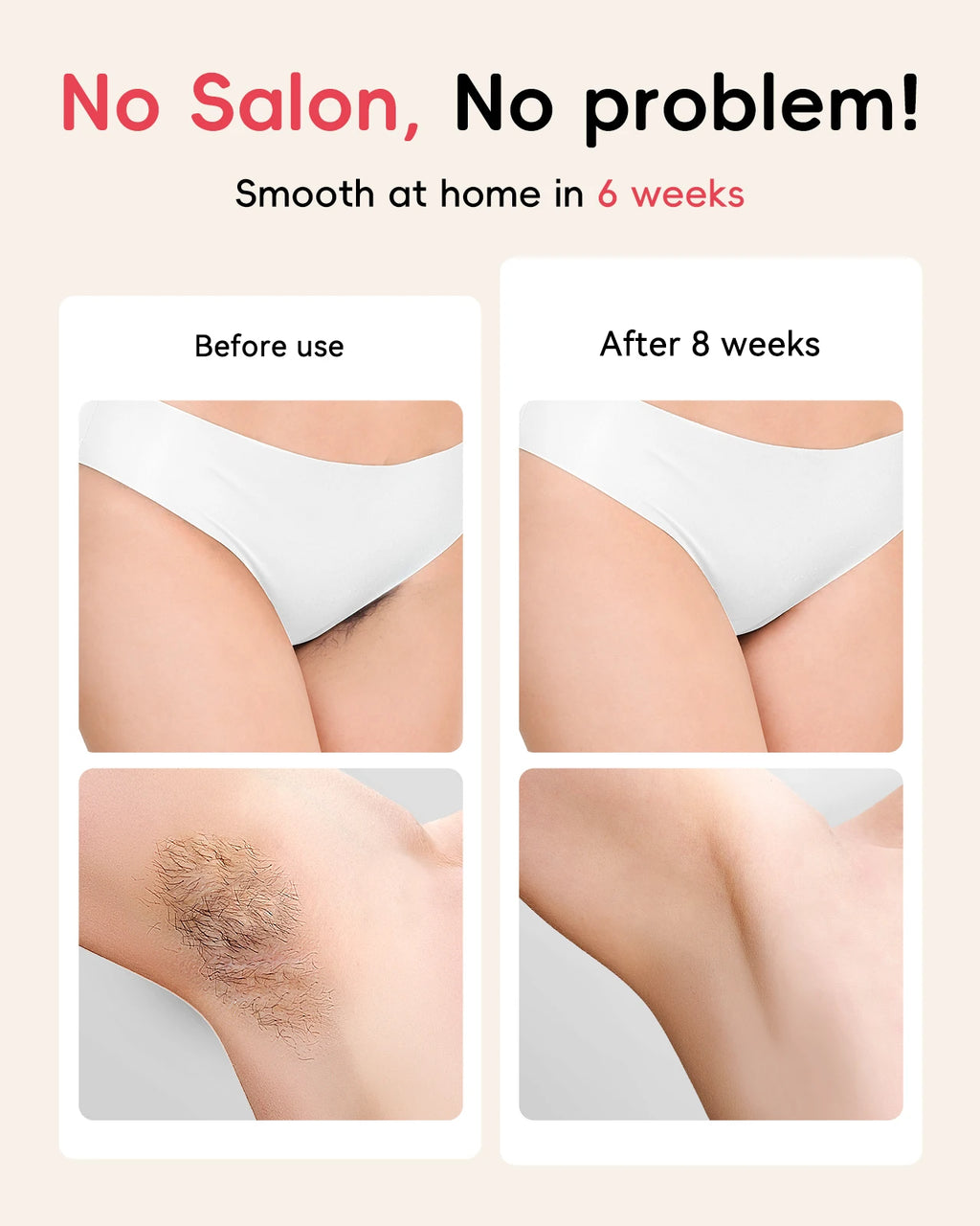 Professional IPL Hair Removal 22J Unlimted Flashes Painless Laser Epilator  Armpits Legs Arms Bikini Line Treament Home Use