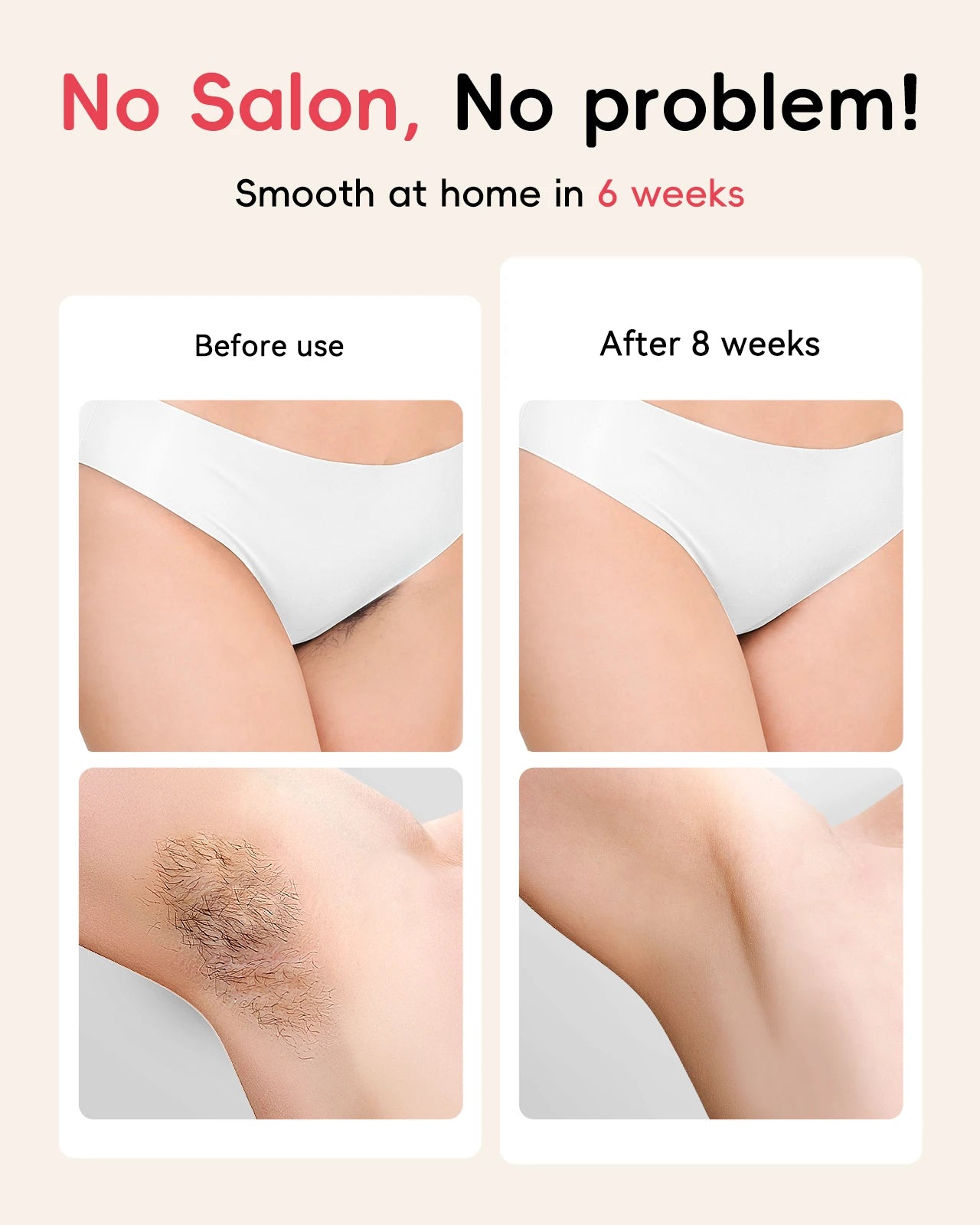 Professional IPL Hair Removal 22J Unlimted Flashes Painless Laser Epilator  Armpits Legs Arms Bikini Line Treament Home Use