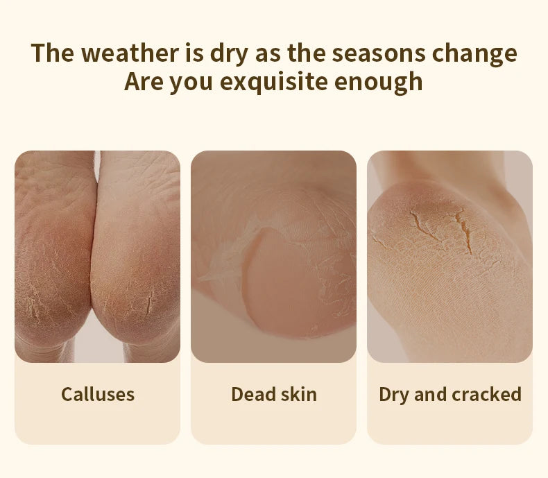 Electric Foot Grinder Automatic Foot Callus Rubbing Pedicure Dead Skin Callus Remover for Foot Rechargeable Foot Beauty Machine