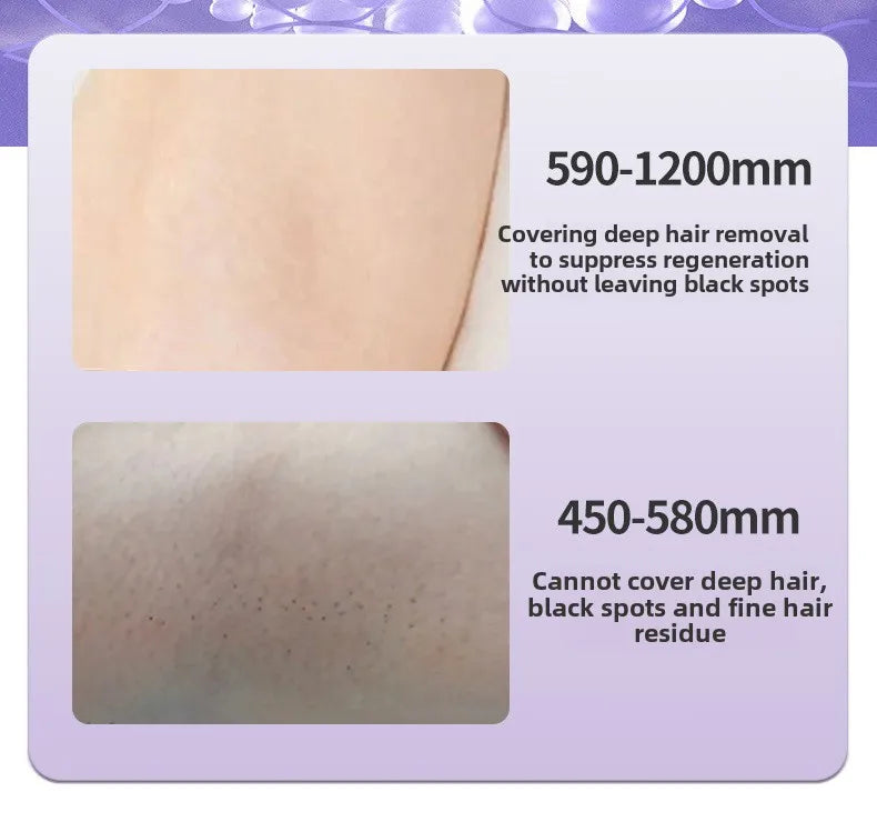 Portable IPL Laser Hair Removal Device with Ice Cooling System Painless for Smooth Skin