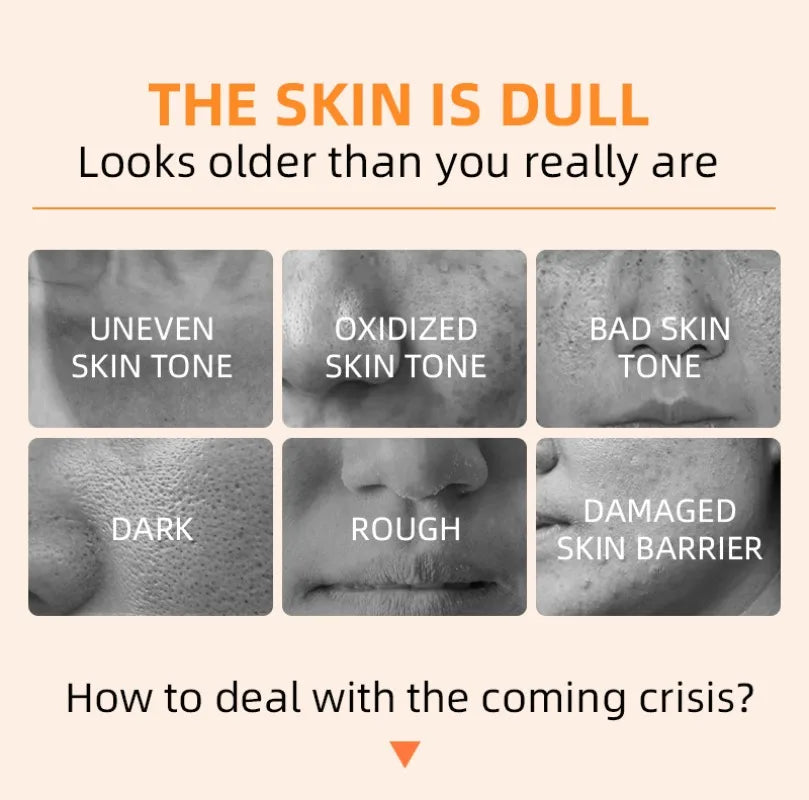 Orange Exfoliating Gel Dead Spot Remover Brighten Peeling 50g Gentle Repair Scrub Whiten Hydrating Moisturizer Korean Skin Care